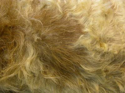 cas-dadenite-sebacee-granulomateuse11