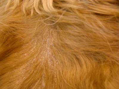 cas-dadenite-sebacee-granulomateuse9