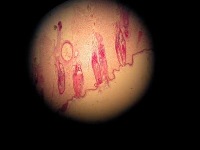 cas-dalopecie-recurrente-flancs-canine7a