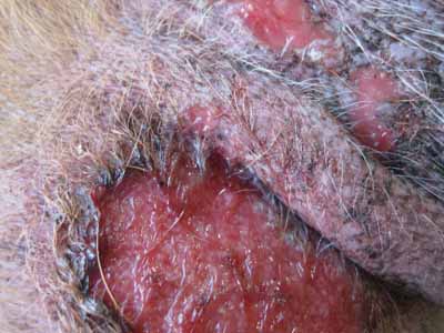 cas-de-carcinomatose-mammaire4
