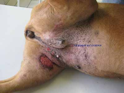 cas-de-carcinomatose-mammaire7