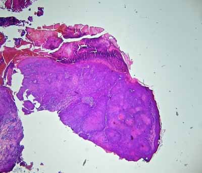 cas-de-carcinome-epidermoide-felin4