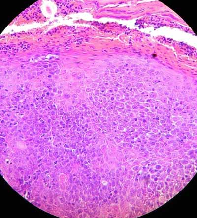cas-de-carcinome-epidermoide-felin6