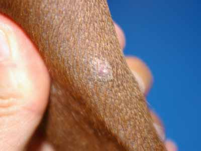 Un cas de dermatite allergique chez un Rhodesian ridgeback