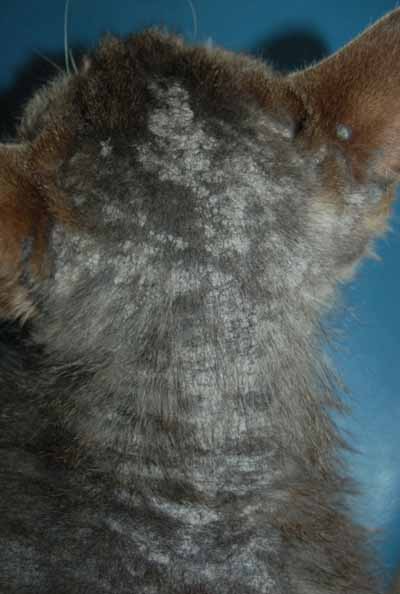 cas-de-dermatite-exfoliative-paraneoplasique-associee-a-thymome4