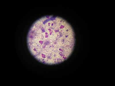 cas-de-dermatite-feline-a-calicivirus4b