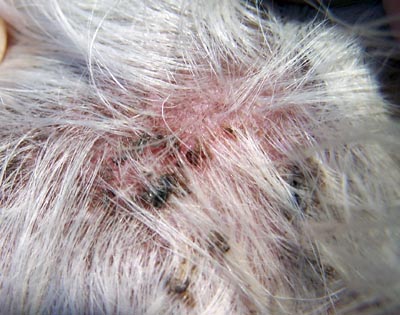 Dermatoses parasitaires