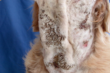 cas-de-dermatite-pyotraumatique-due-a-gale-sarcoptique5