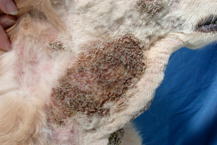 cas-de-dermatite-pyotraumatique-due-a-gale-sarcoptique6