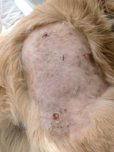 cas-de-dermatite-pyotraumatique-due-a-gale-sarcoptique9
