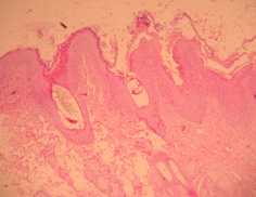 cas-de-dermatose-amelioree-par-le-zinc-chez-une-jeune-chienne5