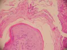 cas-de-dermatose-amelioree-par-le-zinc-chez-une-jeune-chienne6