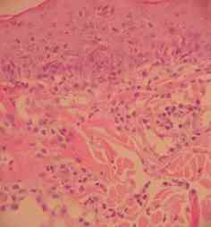 cas-de-dermatose-amelioree-par-le-zinc-chez-une-jeune-chienne7