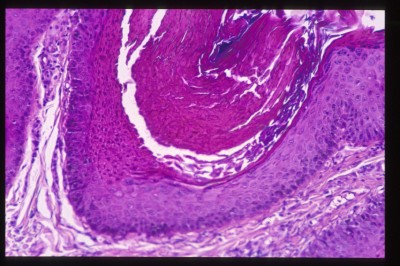 cas-de-dermatose-ichtyosiforme-chez-un-jeune-berger-allemand11