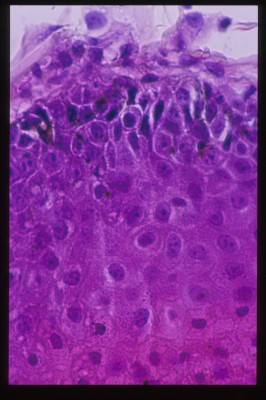 cas-de-dermatose-ichtyosiforme-chez-un-jeune-berger-allemand12