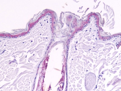 cas-de-dermatose-ichtyosiforme-chez-un-jeune-berger-allemand16