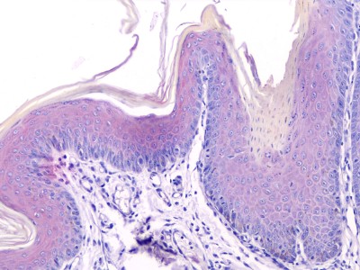 cas-de-dermatose-ichtyosiforme-chez-un-jeune-berger-allemand17