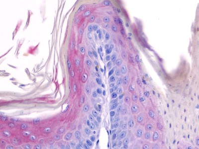 cas-de-dermatose-ichtyosiforme-chez-un-jeune-berger-allemand18