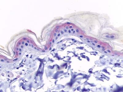 cas-de-dermatose-ichtyosiforme-chez-un-jeune-berger-allemand19