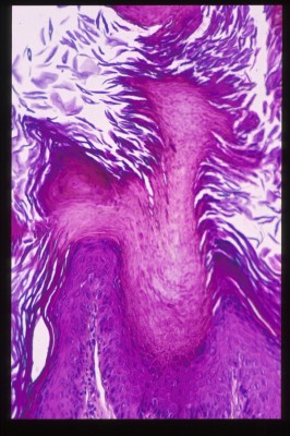 cas-de-dermatose-ichtyosiforme-chez-un-jeune-berger-allemand9