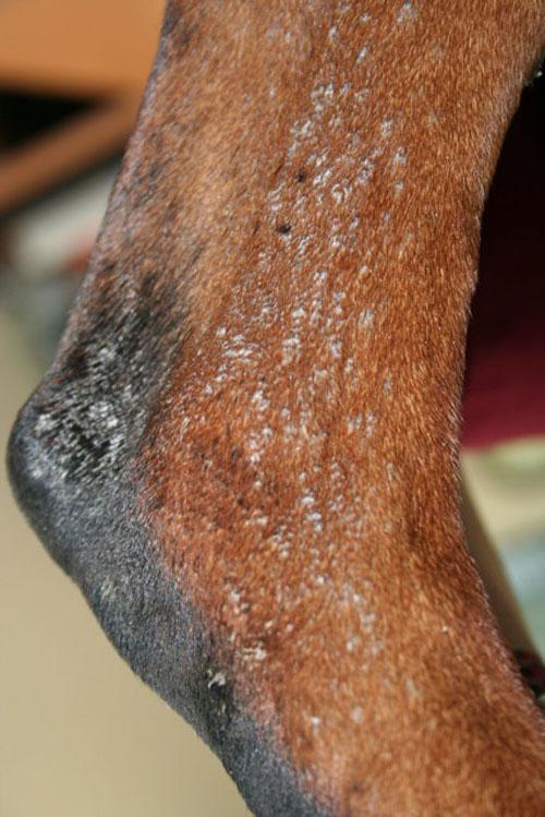 cas-de-dermite-lichenoide-psoriasiforme-dls_ef_tarse_2
