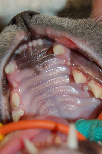 Un cas de granulome éosinophilique répondant à une antibiothérapie