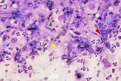 cas-de-granulome-mycosique-felin-2