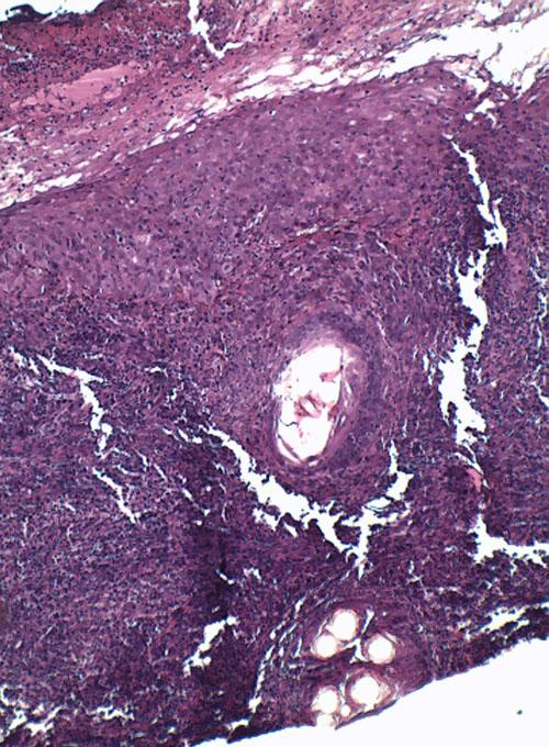 cas-de-leishmaniose-canine3a