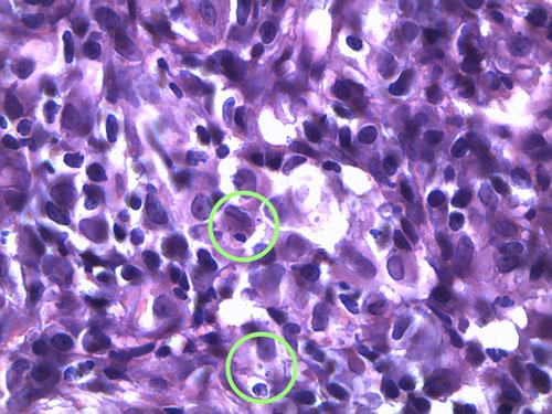 cas-de-leishmaniose-canine3b