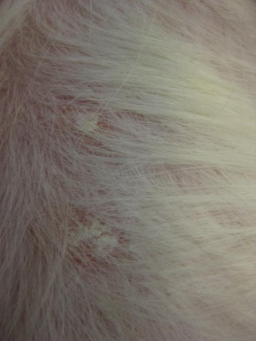 cas-de-lymphome-cutane-epitheliotrope2