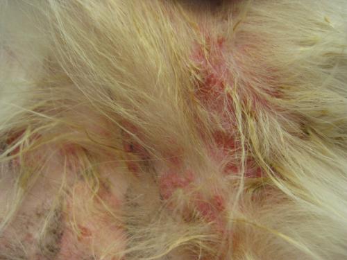 cas-de-lymphome-cutane-epitheliotrope5
