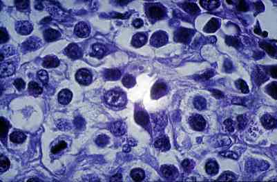 cas-de-mastocytome-multicentrique-traite-lomustine4a