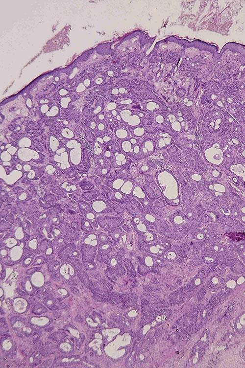 cas-de-metastases-cutanees-dun-adk-pulmonaire-chez-chat10