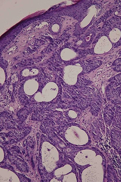 cas-de-metastases-cutanees-dun-adk-pulmonaire-chez-chat11