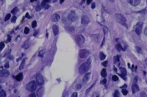 cas-de-metastases-cutanees-dun-adk-pulmonaire-chez-chat13