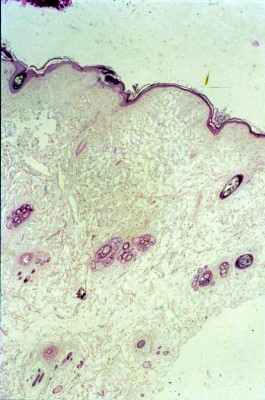 cas-de-mucinose-cutanee-chez-shar-pei10