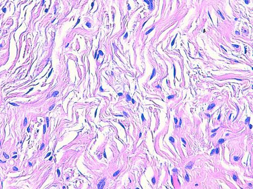 Un cas de neurofibromatose chez une chienne Shetland