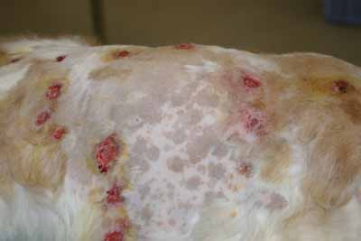 Un cas de panniculite nodulaire stérile idiopathique