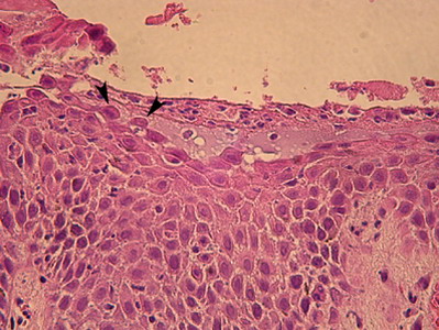 Un cas de pemphigus foliacé chez une chatte