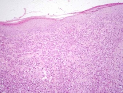 cas-de-pododermatite-plasmocytaire-feline3