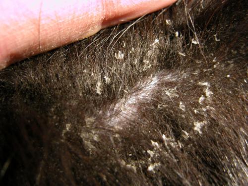 cas-de-syndrome-de-cushing-dorigine-hypophysaire-chez-chien4a
