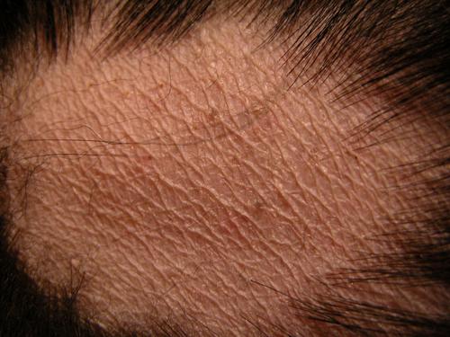 cas-de-syndrome-de-cushing-dorigine-hypophysaire-chez-chien4b