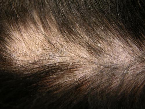 cas-de-syndrome-de-cushing-dorigine-hypophysaire-chez-chien4c