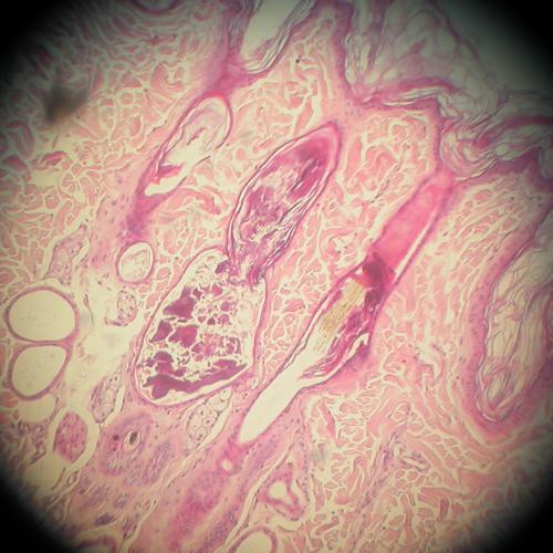 cas-de-syndrome-de-cushing-dorigine-hypophysaire-chez-chien5a