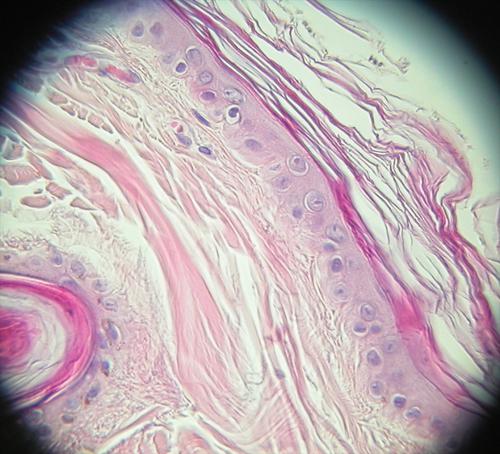 cas-de-syndrome-de-cushing-dorigine-hypophysaire-chez-chien5b