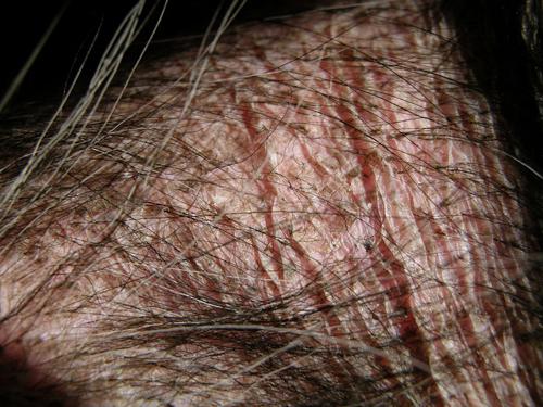 cas-de-syndrome-de-cushing-dorigine-hypophysaire-chez-chien9a