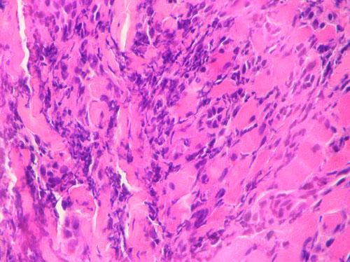 cas-dherpes-virose-feline3