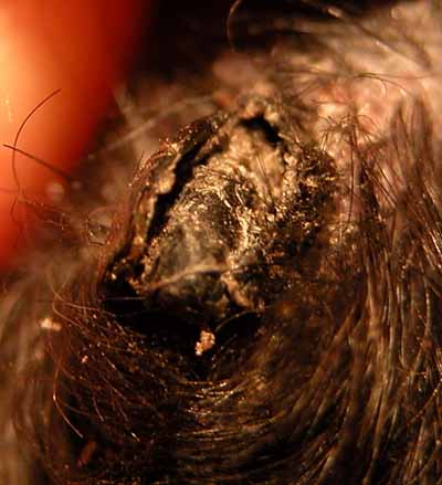 Un cas d'onychodystrophie lupoide symétrique d'un Caniche