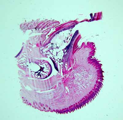 Un cas d'onychodystrophie lupoide symétrique d'un Caniche