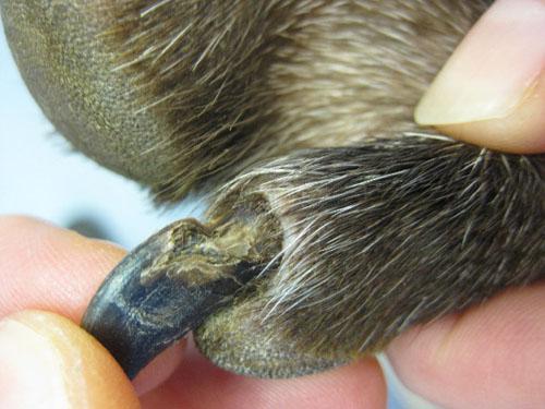 cas-donychodystrophie-lupoide-symetrique3